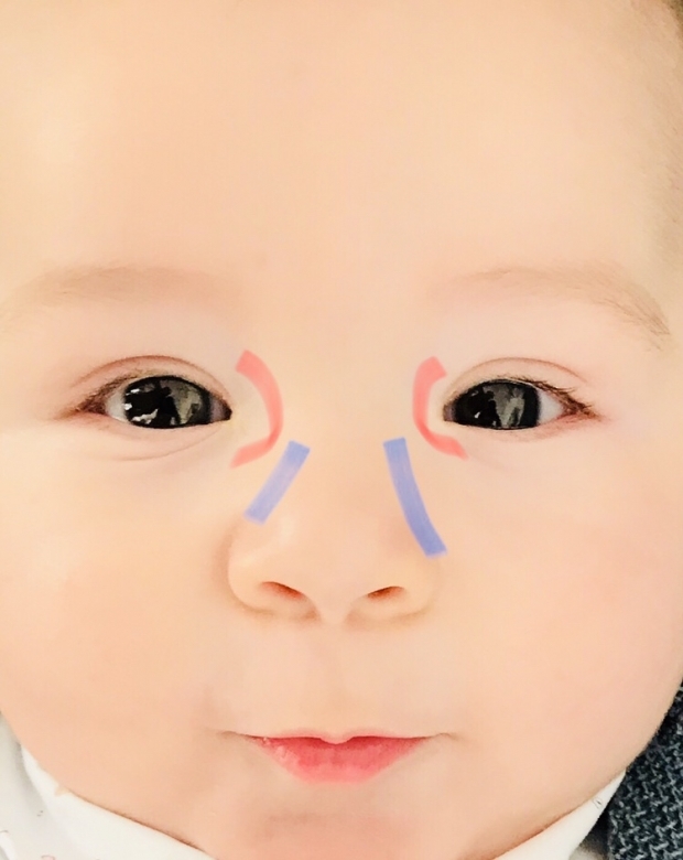 Masaža oka za oči kod beba