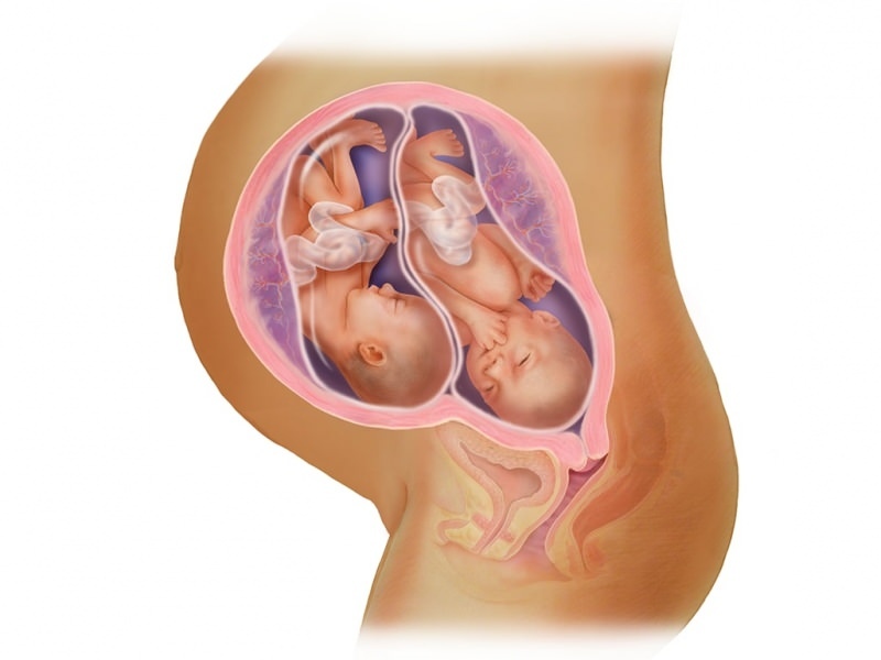 Blizanačka trudnoća u IVF-u! Što je prijenos embrija?