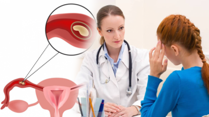 Što je ektopična trudnoća (ektobatska trudnoća), zašto? Koji su znakovi izvanmaterične trudnoće?