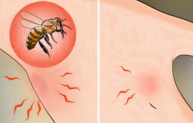 Što je alergija na pčele i koji su simptomi? Prirodne metode koje su dobre za pčelinje ubode