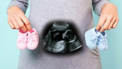 Hoće li se spol djeteta odrediti u prvom tromjesečju trudnoće?
