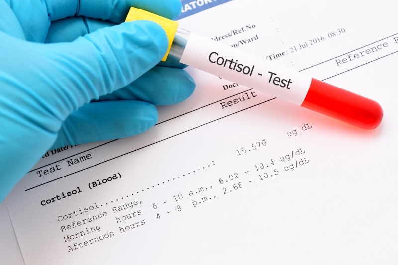 razina kortizola javlja se u krvnim testovima