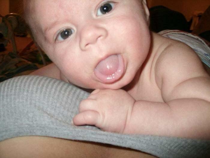 isplaženi jezik kod beba