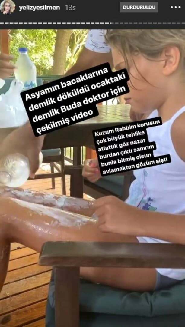 Vrela voda izlila se na noge kćeri Yeliz Yeşilmen