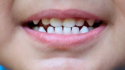 Kako naučiti djecu zubnoj njezi?