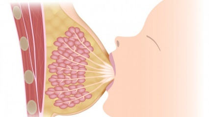 Što je mastitis (upala dojke)? Simptomi mastitisa i liječenje tijekom dojenja