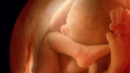 Ne pokazivanje djetetova spola na ultrazvuku! Kako dječaci i djevojčice izgledaju na ultrazvuku?