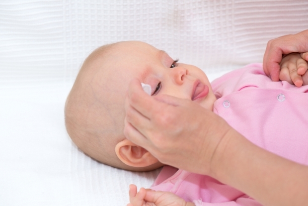 Kako ukloniti brazde kod beba?