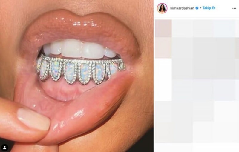 Zubarski dragulj Kim Kardashian za 5000 dolara
