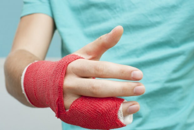 Što uzrokuje lom prsta? Koji su simptomi loma prsta?