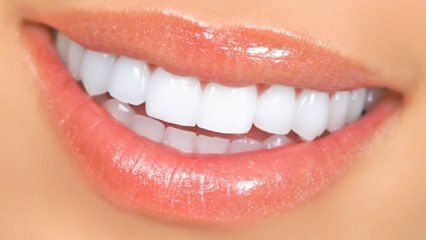 Prirodne metode izbjeljivanja zuba