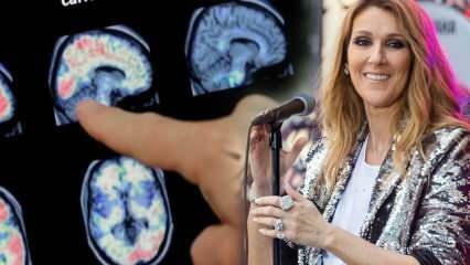 Što je sindrom ukočene osobe? Celine Dion