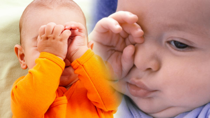 Prirodna rješenja za opekline očiju kod beba