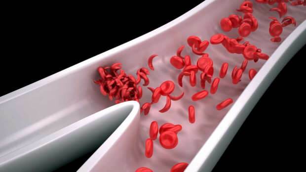 razdražljivost i umor povećavaju se kako se krvne stanice smanjuju