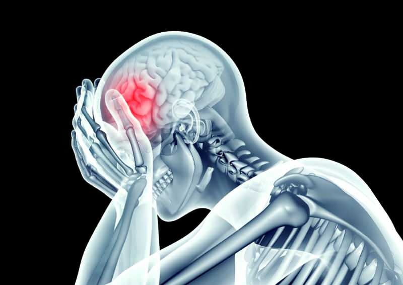 kroonavirus oštećuje mozak sužavanjem žila