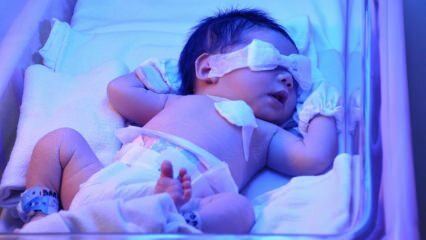 Što je novorođenčasta žutica? Kako žutica u beba prolazi kod kuće? Stupanj žutice u dojenčadi
