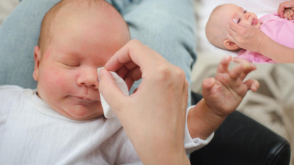 Kako ukloniti rane kod beba? Uzrokuje pupanje oka kod beba? Burr masaža majčinim mlijekom