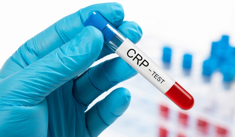 Zašto CRP raste u krvi? Što je CRP? Kako smanjiti CRP?
