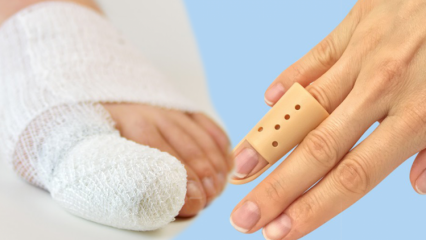 Što uzrokuje lom prsta? Koji su simptomi loma prsta?