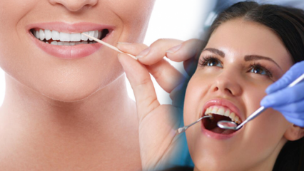 Kako se štiti zdravlje oralnog i zubnog sustava? Koje su stvari koje morate uzeti u obzir pri čišćenju zuba?