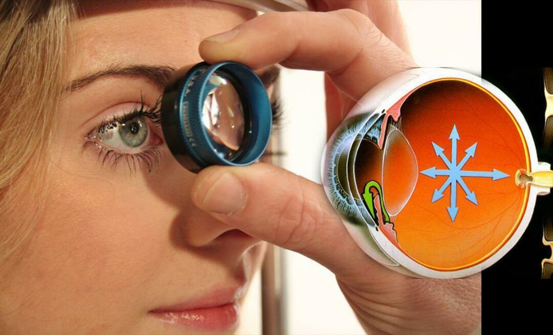 Što je glaukom? Obratite pozornost na ovu bolest koja podmuklo napreduje bez ikakvih simptoma!