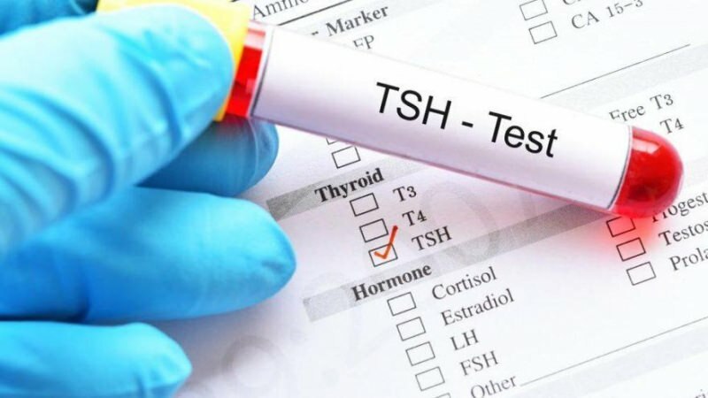 Što je TSH test? Koji su simptomi TSH? Što znači TSH visok i nizak?