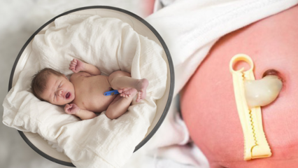 Što je Placenta Previa? Kako učiniti njegu pupčane vrpce kod beba? Ako je pupčana vrpca dugačka ...
