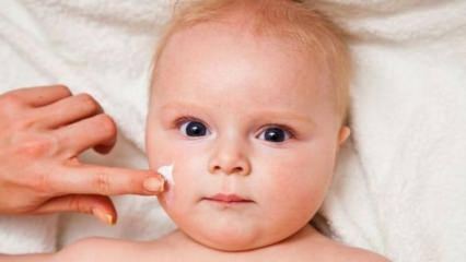 Savjeti za njegu kože beba! Koji su problemi s kožom kod beba?