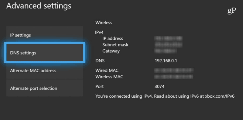 Xbox One DNS postavke