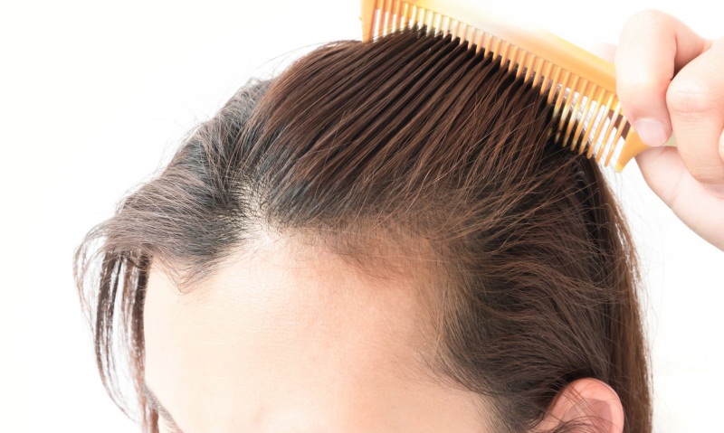 rješenja protiv gubitka kose nakon porođaja! Što je dobro za gubitak kose?