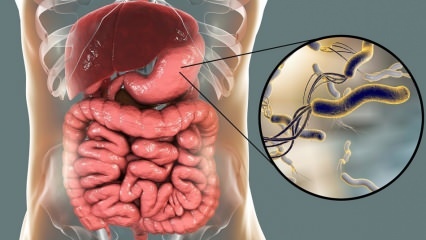 Što je Helicobacter Pylori (mikrob u želucu)? Bolesti uzrokovane Helicobacter Pylori ...