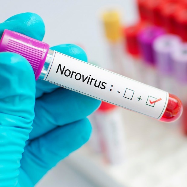 Što je norovirus i koje bolesti uzrokuju