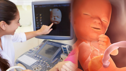 Koji se organ prvo razvija u dojenčadi? Razvoj beba iz tjedna u tjedan