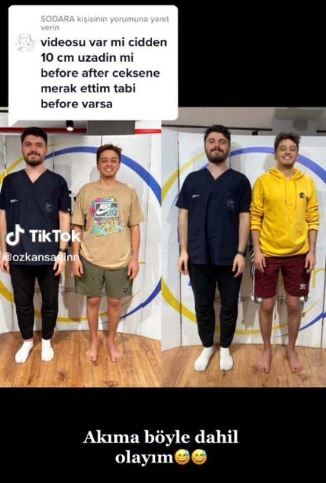 Özkan Sağın prije i poslije operacije