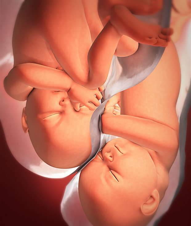 Koji su simptomi blizanačke trudnoće?