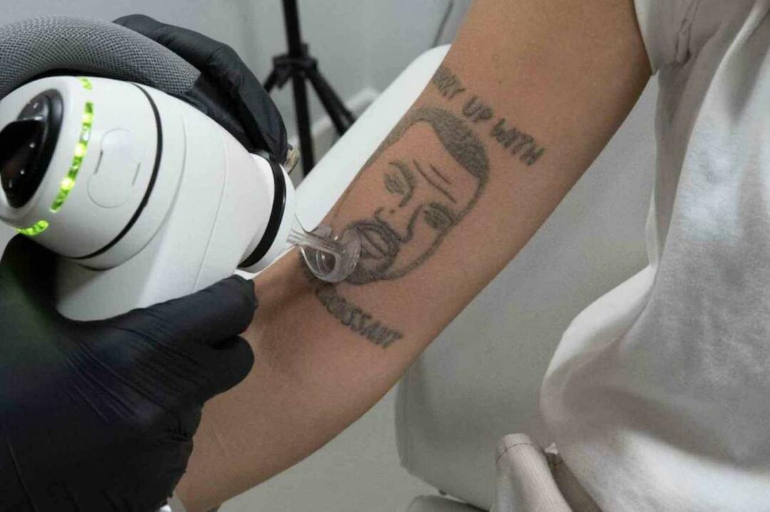 U Londonu će besplatno ukloniti tetovažu Kanyea Westa 