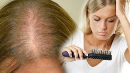 Koja je najučinkovitija metoda protiv gubitka kose? Maskirajte recepte koji zaustavljaju gubitak kose