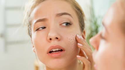 Zašto se koža osuši? Što učiniti na suhoj koži? Najefikasnije preporuke za njegu suhe kože