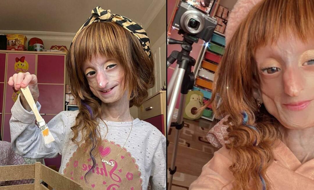 Poznati fenomen Evra Köseoğlu izgubila život! Borio se s progerijom