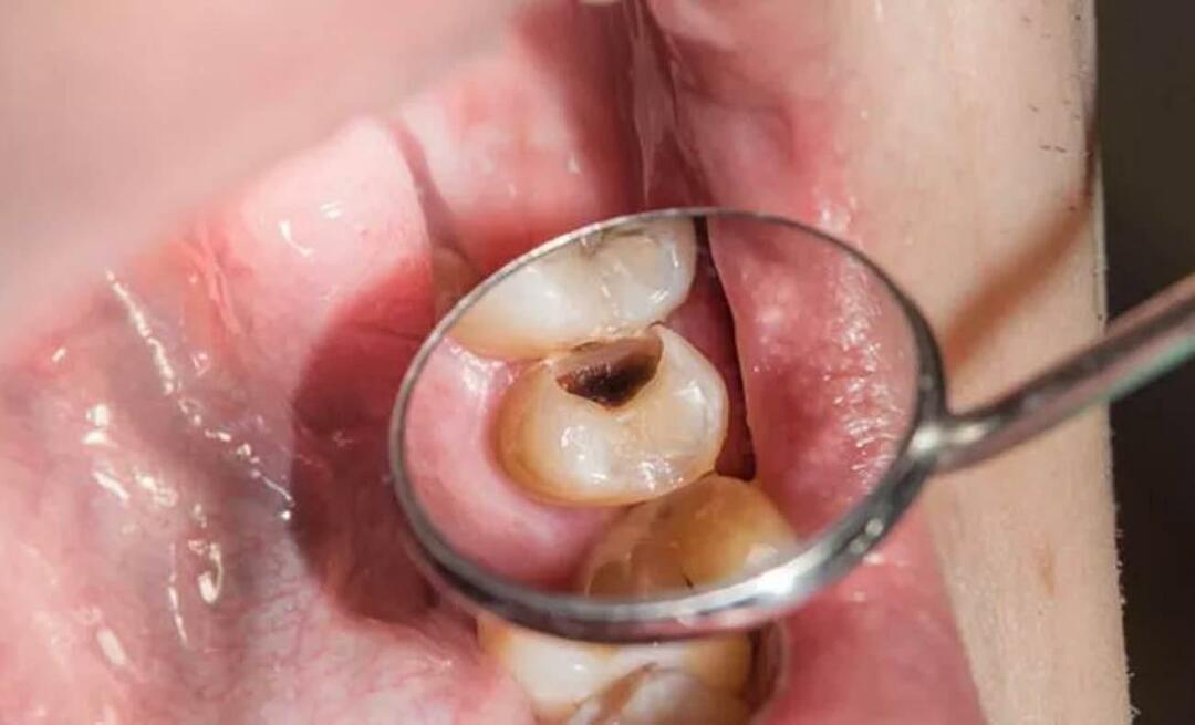 Zašto zubi trunu i što možemo učiniti da to spriječimo? 