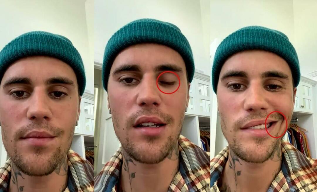 Justin Bieber imao paralizu lica! Slavna zvijezda ne može još jednom na svjetsku turneju