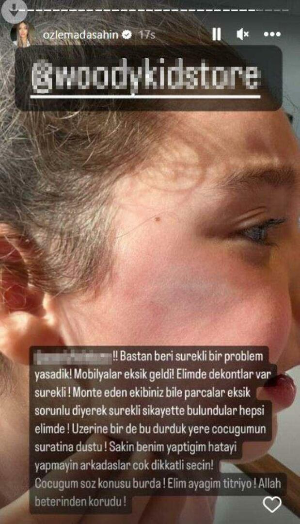 Vrata ormara pala su na lice kćeri Berkaya Şahina