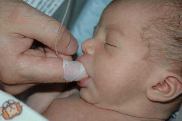 Koja je metoda hranjenja prstima? Kako hraniti dijete špricom?