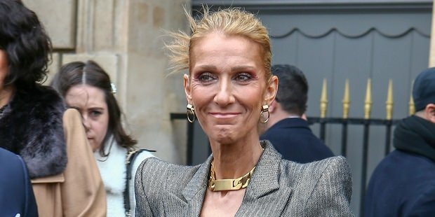 Celine Dion je oslabio