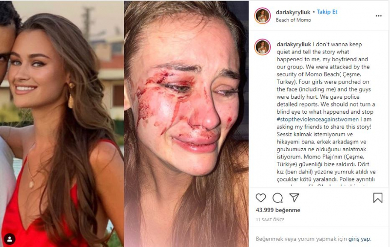 Daria Kyryliuk, manekenka koja je pretučena u İzmir Çeşmeu, uhvatila je koronavirus!