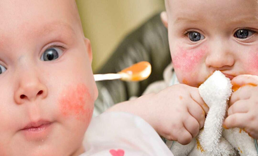 Što treba jesti beba s alergijama? Koja je alternativna hrana za alergične bebe?