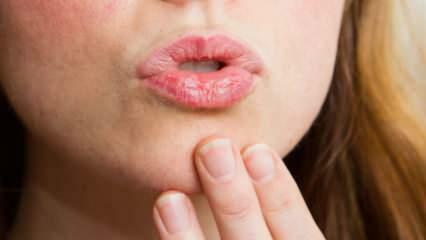 Kako njegovati usne kod kuće? Jednostavna njega suhih usana u 4 koraka