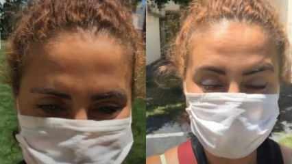 Esra Akkaya, koja je koristila istu masku, dobila je virus! 