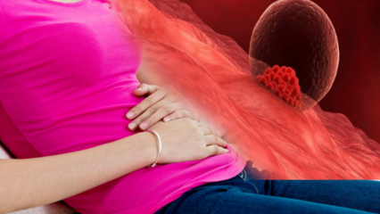 Što je implantacijsko krvarenje tijekom trudnoće? Kako razlikovati implantacijsko krvarenje od menstrualnog