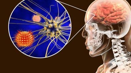 Što je meningitis i koji su njegovi simptomi? Postoji li liječenje meningitisa?